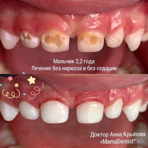 Робота 20